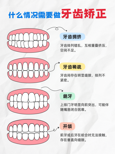 牙齿矫正宣传小红书封面 模板ID：765664