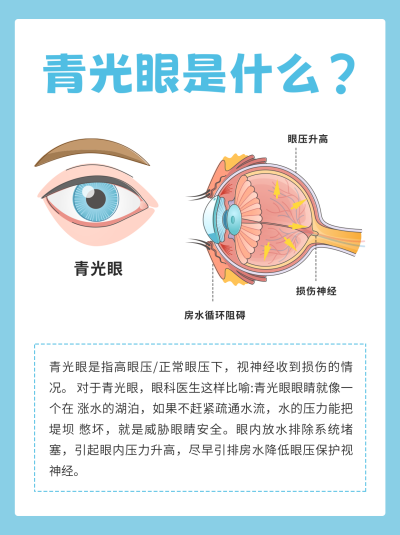 青光眼知识科普小红书封面 模板ID:64222